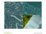 Click to View: 12. Labyrinthula Cell characteristics